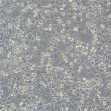 TOV-112D（人上皮性卵巢癌细胞）