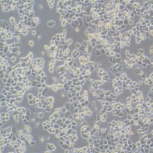 C33A（人宫颈癌细胞）