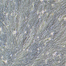 mpc-5（小鼠肾小球足细胞）