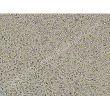 LUVA 细胞， 永生化人肥大细胞系