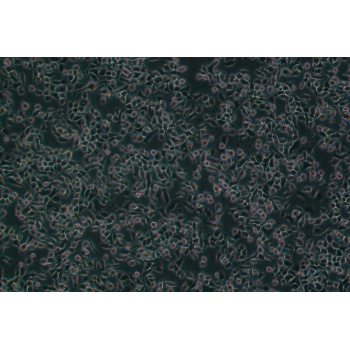 4T1（小鼠乳腺癌细胞）