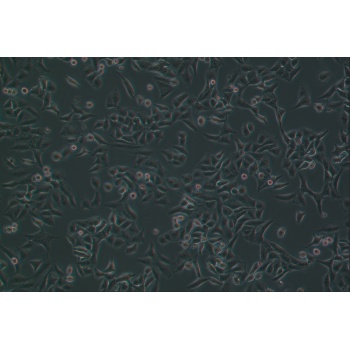 A549 [A-549]（人非小细胞肺癌细胞）