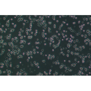 INS-1（大鼠胰岛细胞瘤细胞）