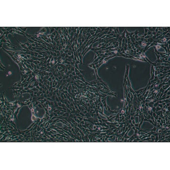 4T1-luc（小鼠乳腺癌细胞-荧光素酶标记）