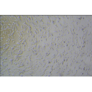 GL261（小鼠胶质瘤细胞）