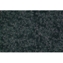 4T1（小鼠乳腺癌细胞）