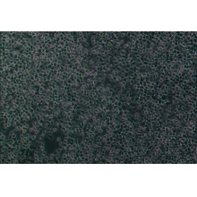 NCI-H1975（人肺腺癌细胞）