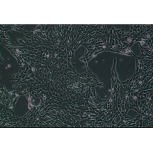 4T1-luc（小鼠乳腺癌细胞-荧光素酶标记）