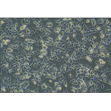 GL261-LUC（小鼠胶质瘤细胞带荧光素酶）