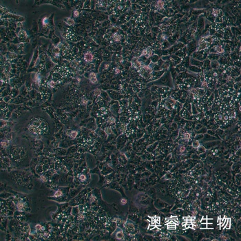 HCT-116 人结肠癌细胞
