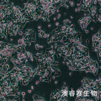 Hepg2 人肝癌细胞