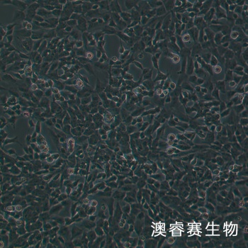 SH-SY5Y 人神经母细胞瘤细胞