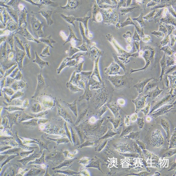 A375 人黑色素瘤细胞