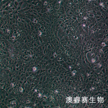 HMC 人肾小球系膜细胞