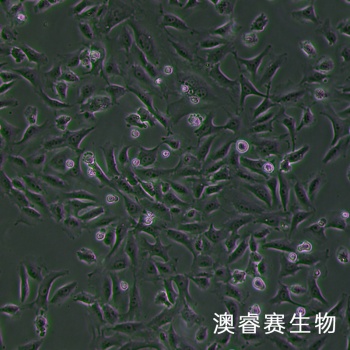 hRMECs（人视网膜微血管内皮细胞）