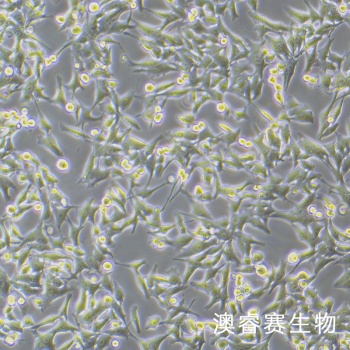 WRL68 人正常肝细胞
