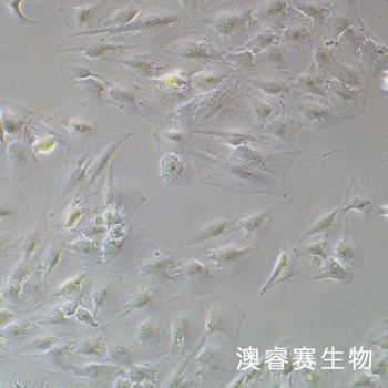 SNU-387 人肝癌细胞