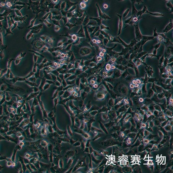 HCC1806 人乳腺鳞状癌细胞（三阴性）
