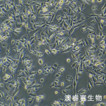 SW 756 人子宫鳞状癌细胞