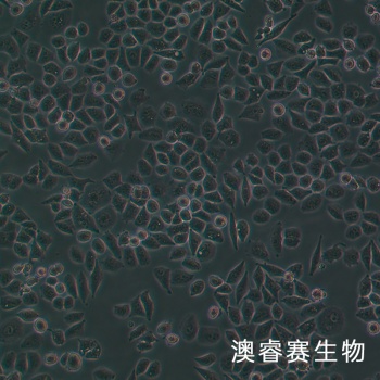 IOSE-80 人正常卵巢上皮细胞系