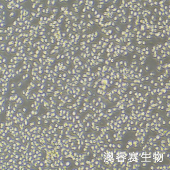 MEC-1 人慢性B细胞白血病细胞