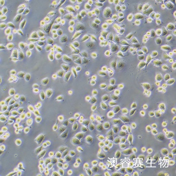 HEEC 人正常食管上皮细胞