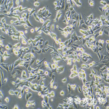 SNU398 人肝癌细胞