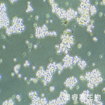Hut-102 人T淋巴瘤细胞