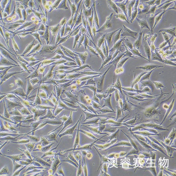 SK-MEL-28 人恶性黑色素瘤细胞