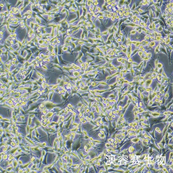 CBRH7919细胞；大鼠肝癌细胞