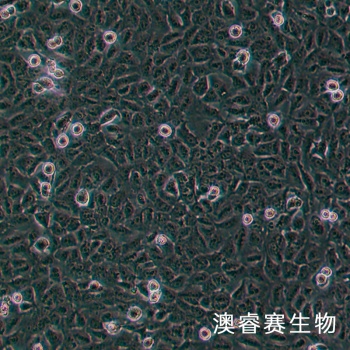 Ovcar 8 人卵巢癌腺癌细胞