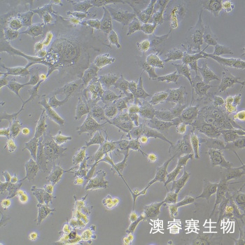 HEY A8 人卵巢癌细胞