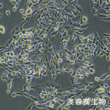 SUM159PT细胞；人乳腺癌细胞