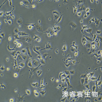 DMS-114细胞 人小细胞肺癌细胞