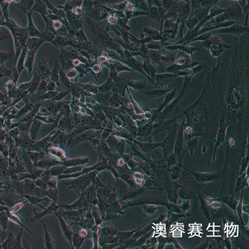 SW1783细胞；人脑星形胶质瘤细胞