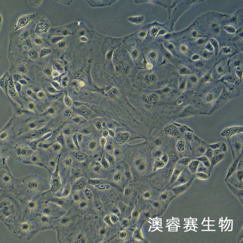 KURAMOCHI细胞 人卵巢癌细胞