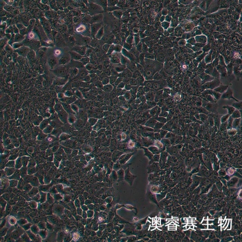 TE-10细胞；人食管癌细胞