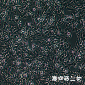 CTX TNA2（大鼠星形胶质细胞）