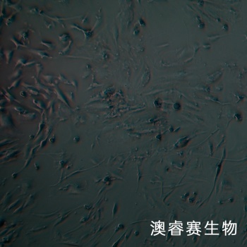 hEM15A；人永生化子宫异位内膜上皮细胞