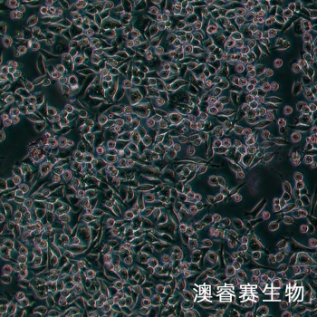 SNU601细胞;人胃癌细胞