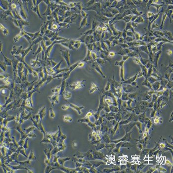 12Z细胞;人源子宫内膜异位细胞