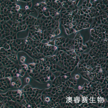 MKU74细胞;人胃癌细胞