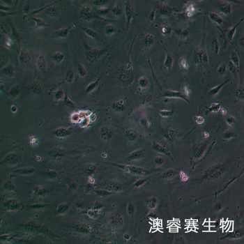 HLEC细胞;人晶状体上皮细胞