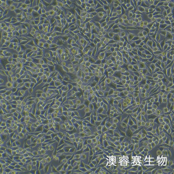 L-WRN细胞;小鼠皮下结缔组织细胞