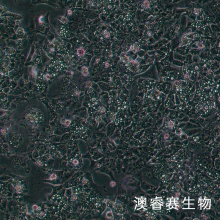 HCT-116 人结肠癌细胞