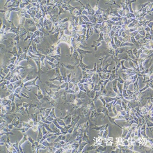 Hep3B 人肝癌细胞