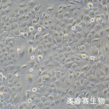 HMC 人肾小球系膜细胞