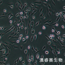 hRMECs（人视网膜微血管内皮细胞）