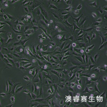 hRMECs（人视网膜微血管内皮细胞）