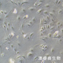 SNU-182 人肝癌细胞